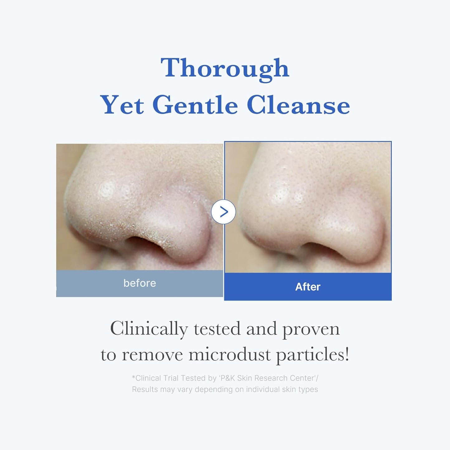medicube - Zero Foam Cleanser - 120ml
