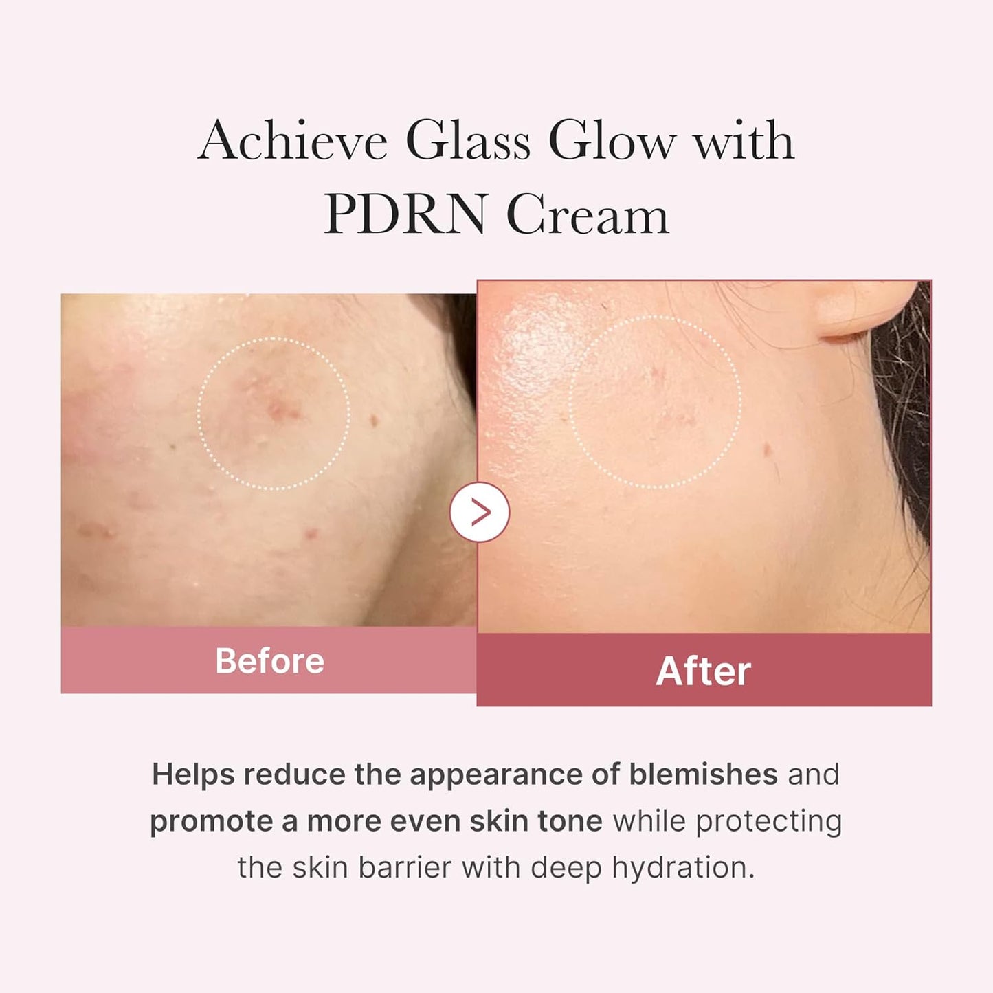 medicube PDRN Pink hyaluronic moisturizing Cream 50ml
